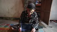 Nenek Sarjinah, warga Desa Sidoharjo, Kecamatan Jambon, Kabupaten Ponorogo, Jawa Timur itu belum merdeka dari kemiskinan dan penyakit kanker kulit menggerogoti matanya. (Liputan6.com/ Dian Kurniawan)