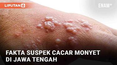 Belakangan beredar kabar temuan cacar monyet (monkeypox) di Jawa Tengah. Kementerian Kesehatan menyatakan ada satu pasien suspek monkeypox di Jateng. Pasien alami gejala-gejala yang mirip dengan monkeypox. Namun pasien tersebut belum terkonfirmasi po...