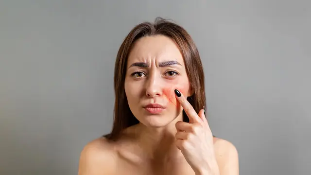 3 Efek Samping Pemakaian Retinol yang Kurang Tepat dan Cara Terbaik Mencegahnya