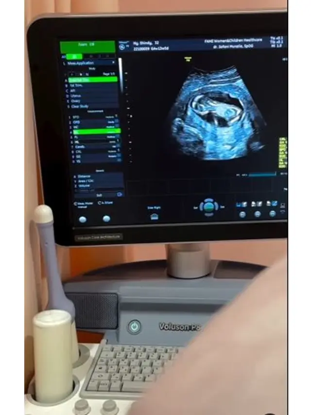 6 Potret Kakak Ria Ricis Umumkan Kehamilan Kedua, Baby Bump Mulai Terlihat