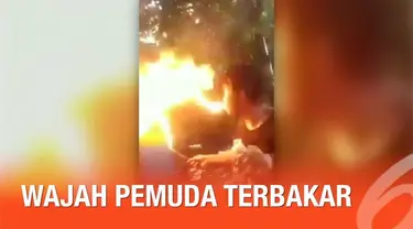 Secara tiba-tiba api menjalar ke wajah si pemuda ketika ia mencoba atraksi sembur api.