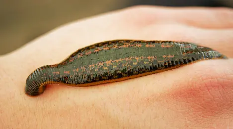 7 Arti Mimpi Digigit Lintah Yang Menjadi Pertanda Baik Maupun Buruk -  Lifestyle Fimela.com