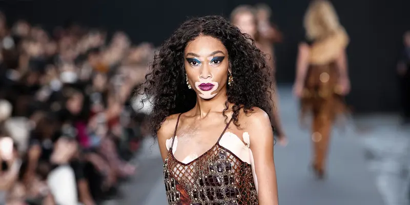 Winnie Harlow di Panggung Paris Fashion Week