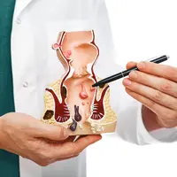 Hemoroid atau ambeien atau wasir/Shutterstock.