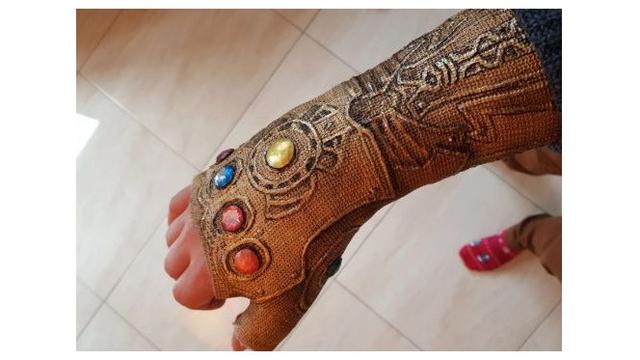 Pergelangan Tangannya Cedera, Pria Ini Gunakan Hiasan Gips yang Unik