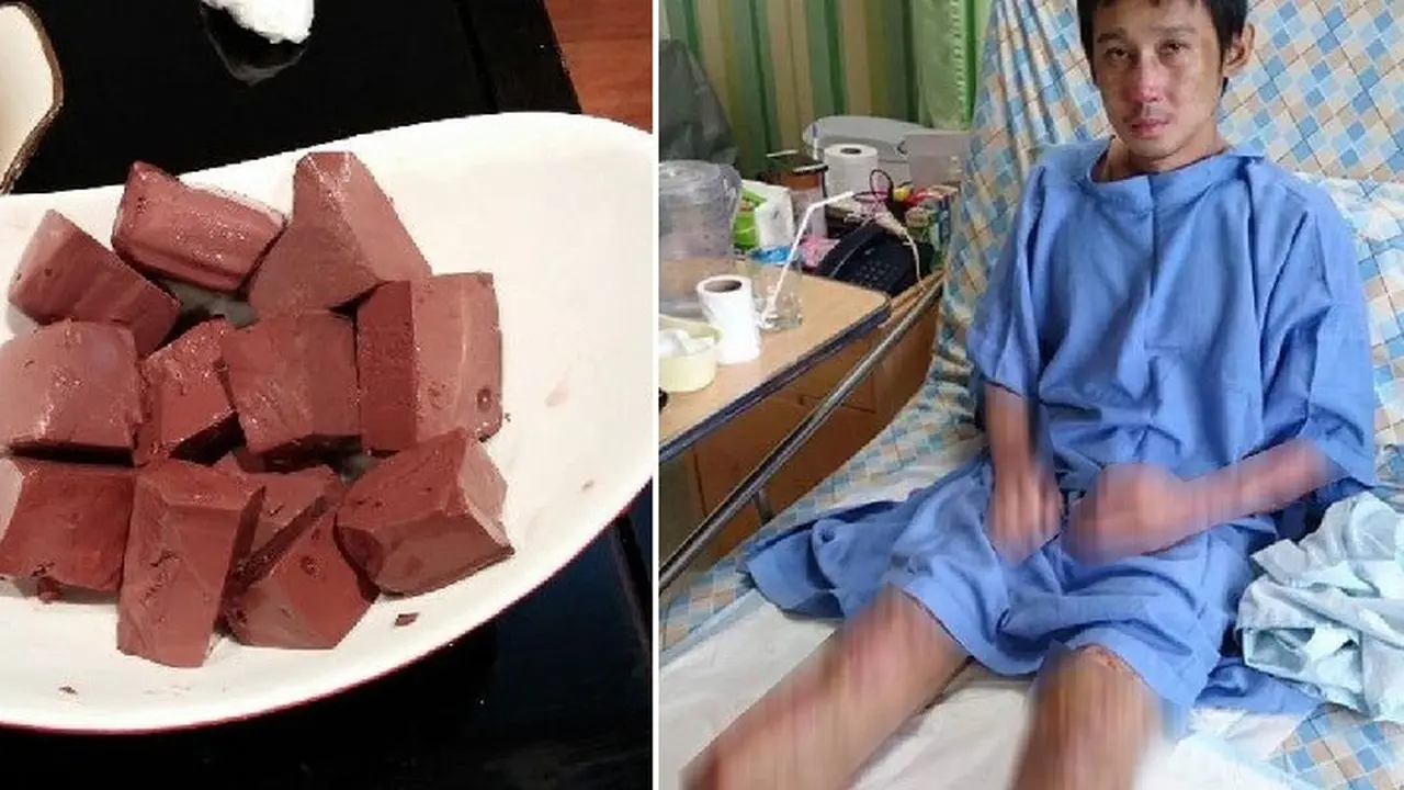 pria alami infeksi serius usai makan darah babi