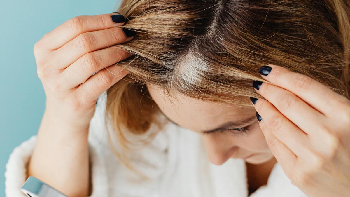 Cara Mengatasi Rambut Pitak dengan Trik Makeup Sederhana