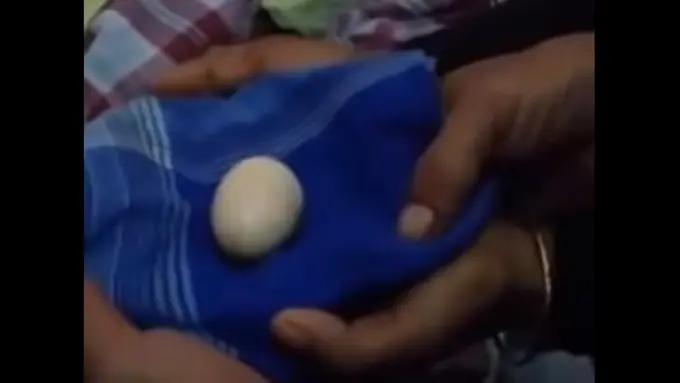 Bocah Bertelur Asal Sulsel Hebohkan Dunia Maya