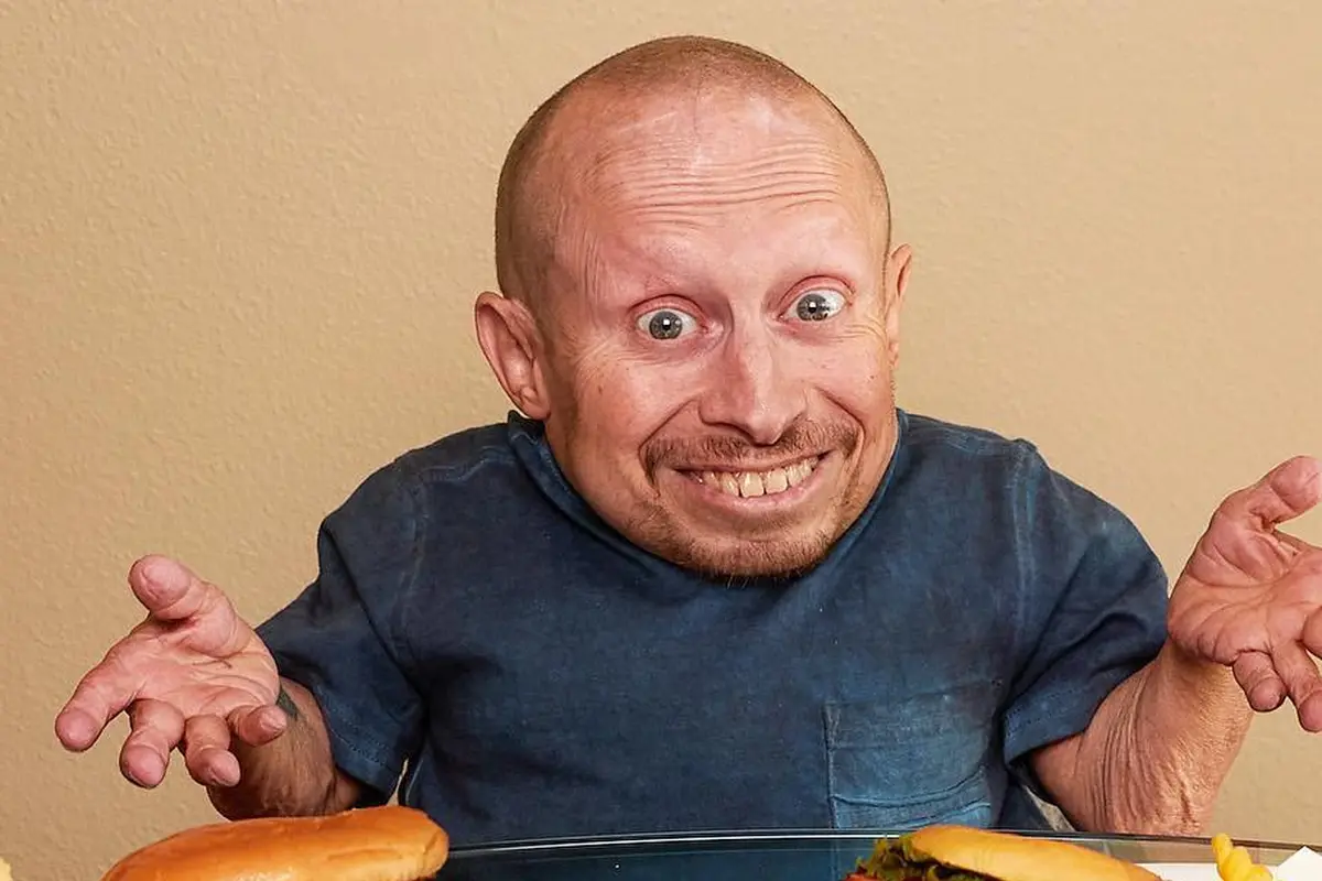 [Bintang] Pemeran Mini-Me di Austin Powers, Verne Troyer Meninggal Dunia