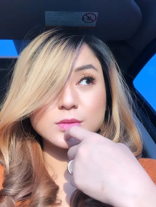 Beruntung mendapat pengobatan yang tepat dan cepatnya terdeteksi penyakit tersebut, Juwita Bahar pun bisa terselamatkan.  (Instagram/juwitasanjaya11)