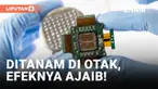 Menariknya, tak hanya bantuan medis, Gert-Jan yang seorang insinyur ini bisa berjalan karena teknologi implan perangkat elektronik dan kecerdasan buatan (AI).