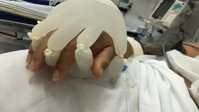 Hanya Pakai Sarung Tangan, Perawat Ini Atasi Rasa Kesepian Pasien Covid-19