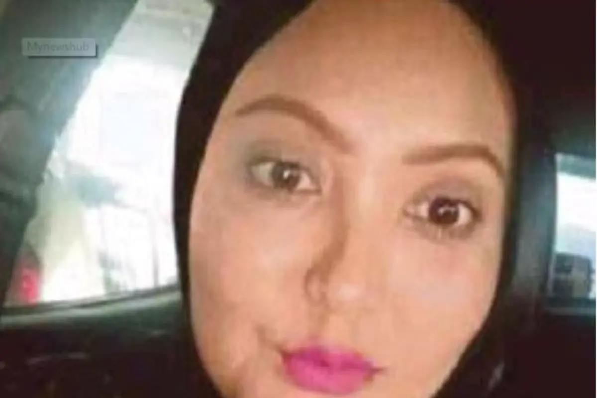 [Bintang] Ketagihan Suntik Kolagen, Hal Mengerikan Terjadi Pada Wanita Ini