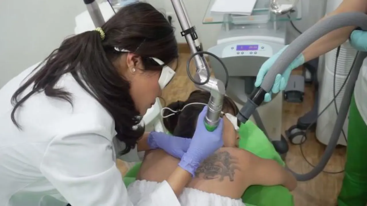 Menghapus Tato