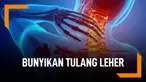 Ini Cara Menghentikan Kebiasaan Bunyikan Tulang Leher