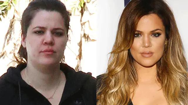 Khloe Kardashian