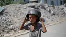 UNRWA menyebut bahwa salah satu kliniknya di Gaza mencatat peningkatan jumlah kasus malnutrisi sejak Maret 2025 lalu, ketika pengepungan total oleh Pemerintah Israel mulai diberlakukan. (Eyad BABA/AFP)