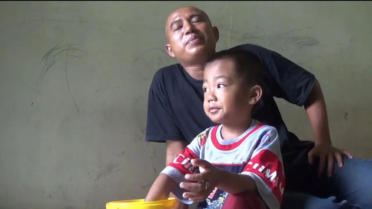 Cincin Batu Akik yang Tersangkut di Jari Bocah Akhirnya Lepas