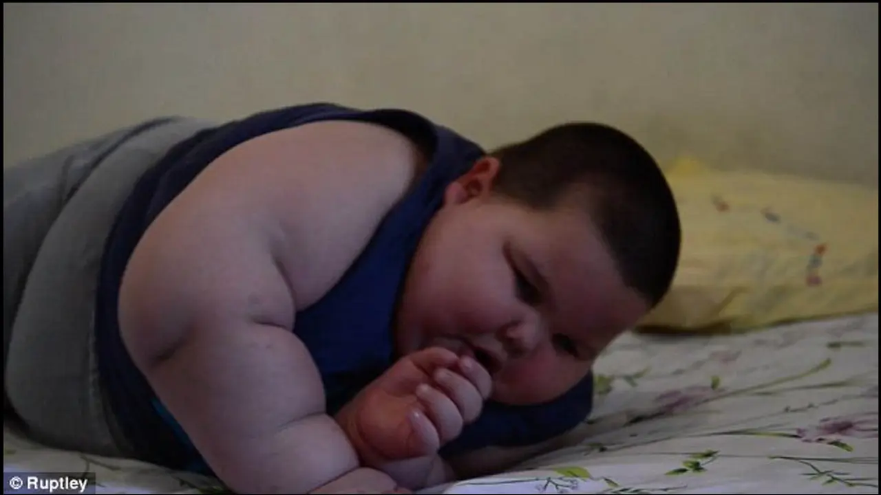 Tak Bisa Berhenti Makan, Bocah Tiga Tahun Ini Berbobot 70 Kg 