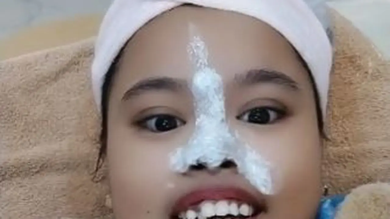 6 Potret Terbaru Kekeyi Setelah Filler Hidung, Tampil Beda