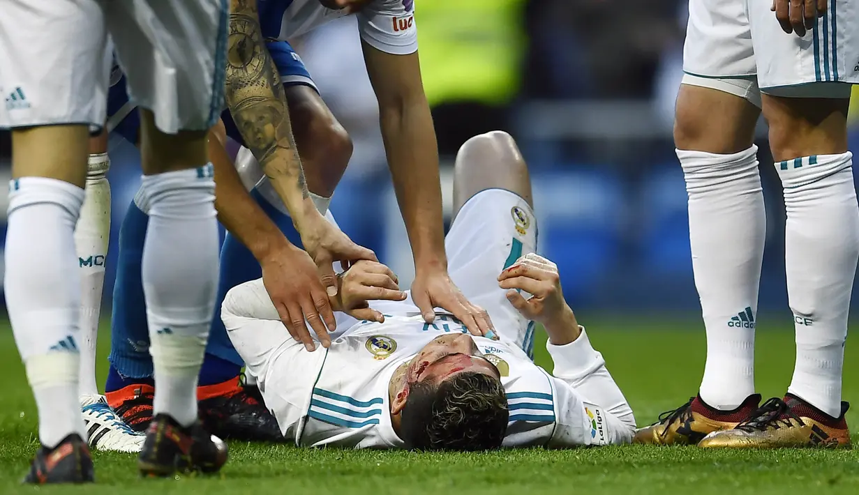 Striker Real Madrid, Cristiano Ronaldo, mengalami pendarahan di bagian pelipis saat melawan Deportivo La Coruna pada laga La Liga di Stadion Santiago Bernabeu, Minggu (21/1/2018). Real Madrid menang 7-1 atas Deportivo La Coruna. (AFP/Oscar Del Pozo)