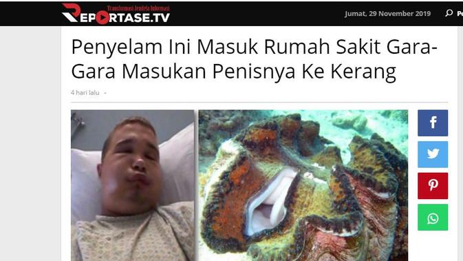 [Cek Fakta] Pria Masukkan Alat Kelamin ke Dalam Kerang Raksasa Lalu Komplikasi, Benarkah?