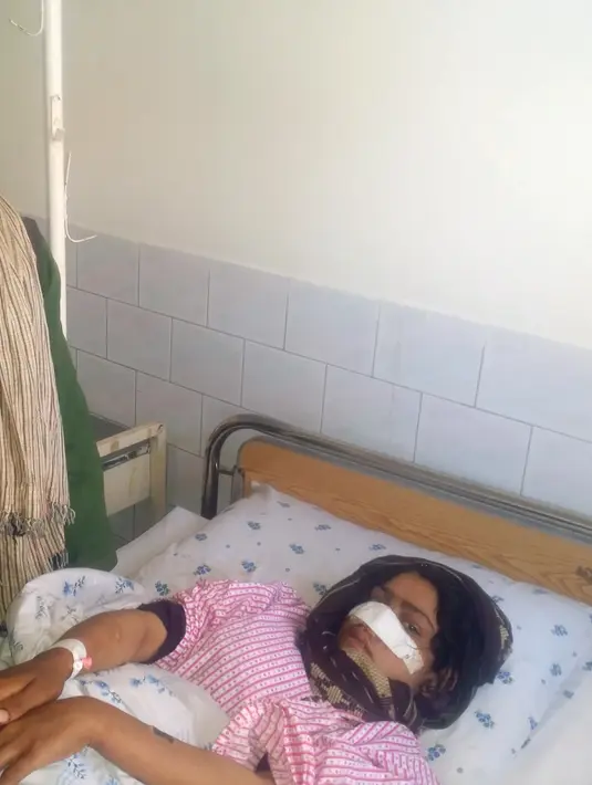 Reza Gul (20) saat tergolek lemah di sebuah rumah sakit di Provinsi Faryab, Afghanistan, 19 Januari 2016. Wanita yang telah enam tahun menikah itu mengalami cacat fisik setelah sang suami memotong hidungnya dengan pisau. (AFP PHOTO/Hasan Sirdash)
