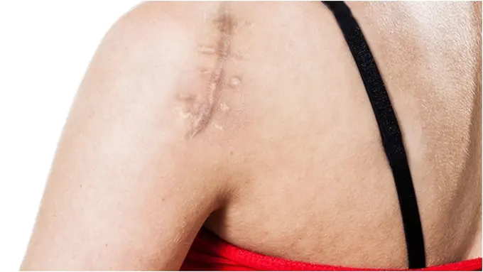 Courtesy ShutterStock.com