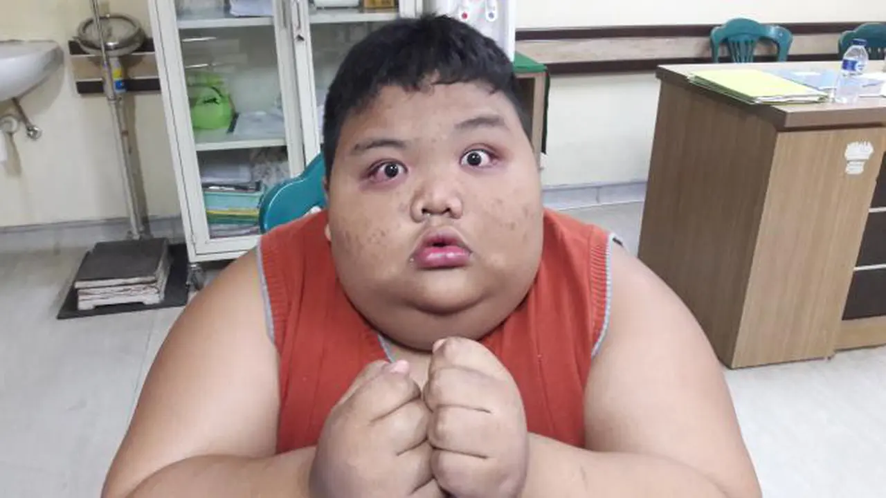 Top 3: Jeritan Hati Ibu Bocah Obesitas Palembang