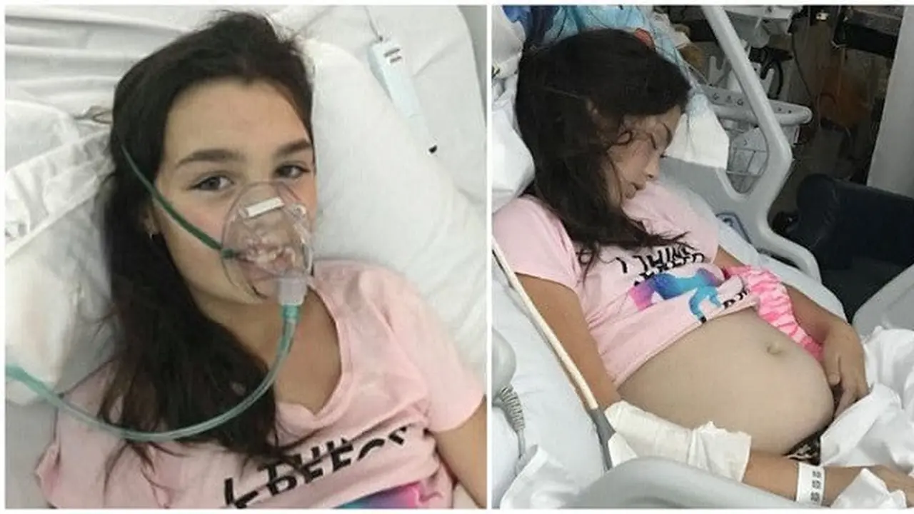 Disangka Hamil, Ternyata Ini Penyebab Besarnya Perut Bocah 11 Tahun