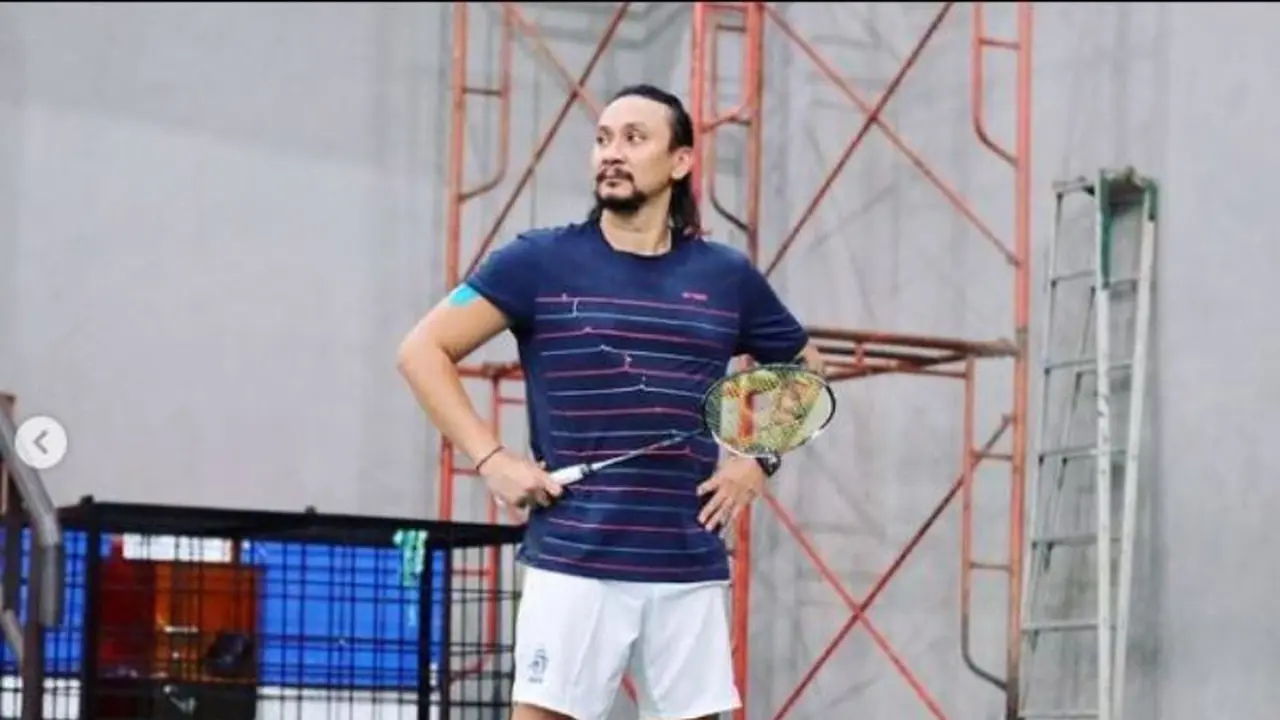 Vincent Rompies Akui Pernah Jalani Operasi Plastik, Apa Alasannya?