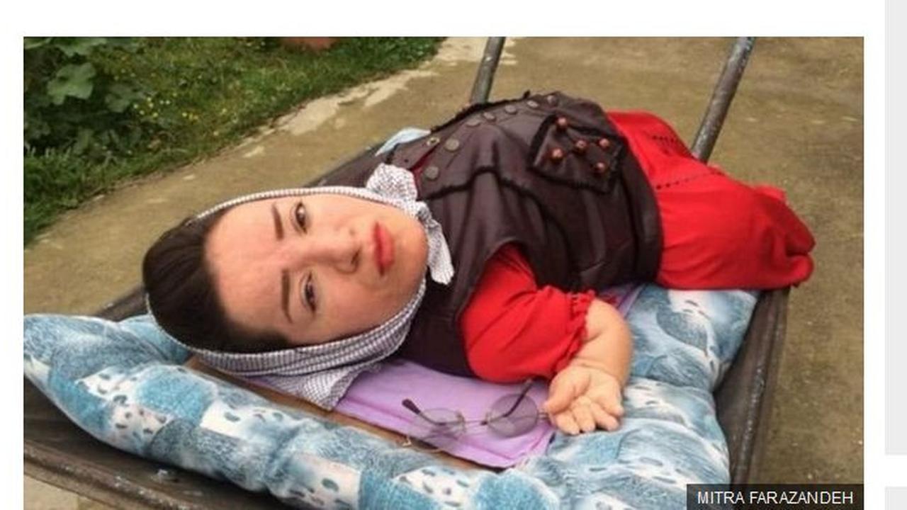 Kisah Cinta Mitra Farazandeh di Tengah Kondisinya Jadi Disabilitas