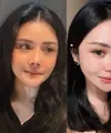 Lihat di sini beberapa potret terbaru Mawar AFI yang dipuji makin cantik dan operasi plastiknya berhasil.