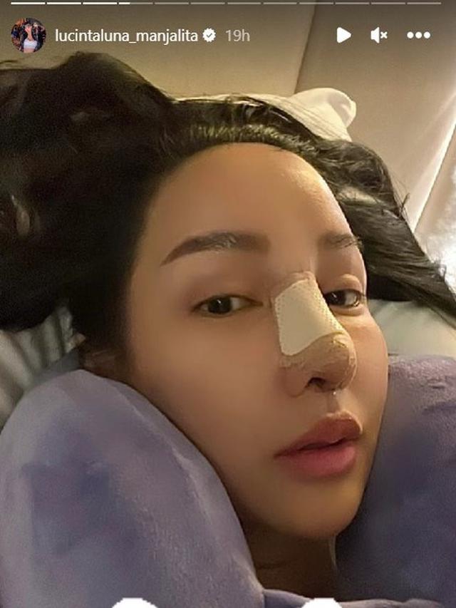 6 Potret Terbaru Lucinta Luna Usai Jalani Oplas Lagi, Kesal Disebut Aneh