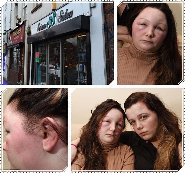  Alergi  Cat  Rambut  Wajah Wanita Ini Bengkak Lifestyle 