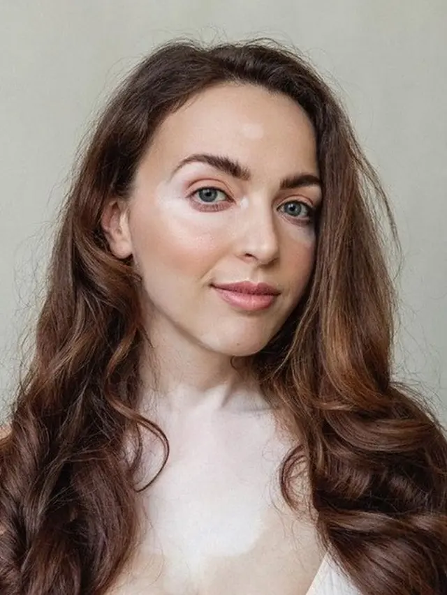 model vitiligo