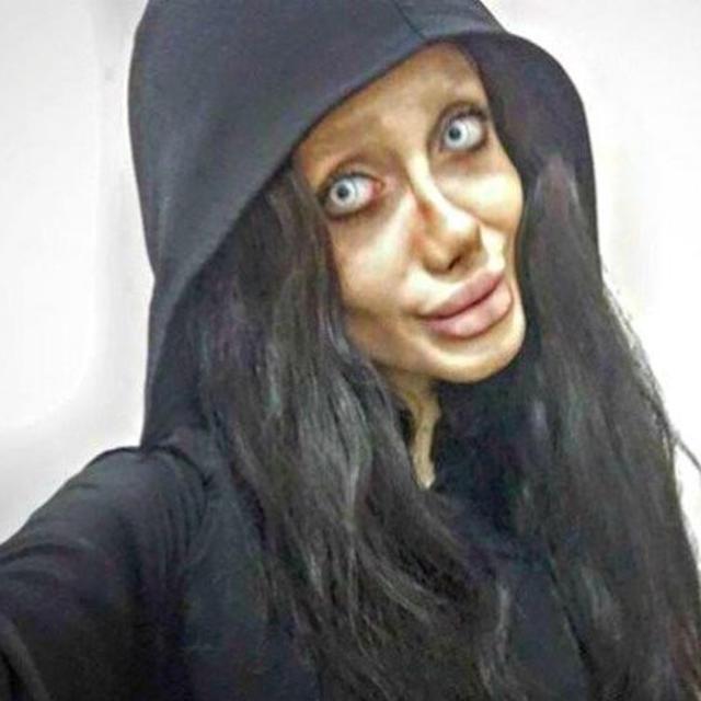 Gadis Yang Operasi Mirip Jolie Ternyata Bohong Ini Wajah Aslinya Citizen6 Liputan6 Com