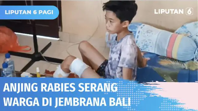 Sejumlah warga Jembrana, Bali kembali menjadi korban gigitan anjing yang diduga terjangkit rabies. Salah seorang korban yang masih bocah mengalami luka cukup parah. Kini tiga ekor anjing dibunuh untuk diambil otaknya sebagai sampel penelitian.