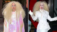Sering Pakai Sky-High Heels, Kaki Lady Gaga Alami Abrasi