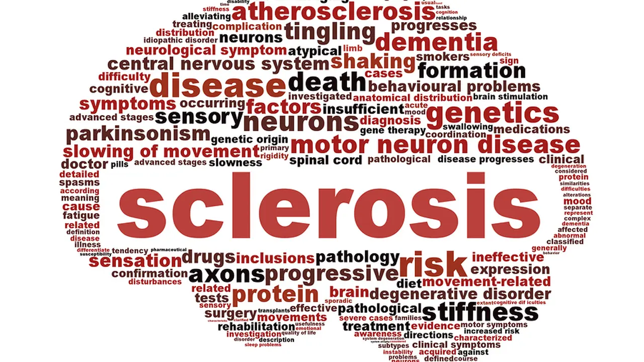 Mengenal Multiple Sclerosis, Penyakit Pepeng Jari-jari