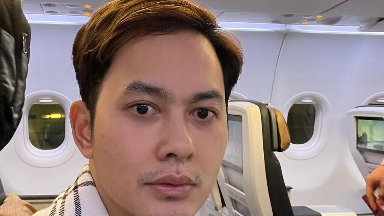 7 Potret Kiki Farel Transplantasi Rambut, Seru Nikmati Liburan Sebelum Operasi