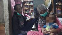 Laila Fitria, bayi stunting berusia 23 bulan yang menderita kelamin ganda (Liputan6.com/Istimewa)