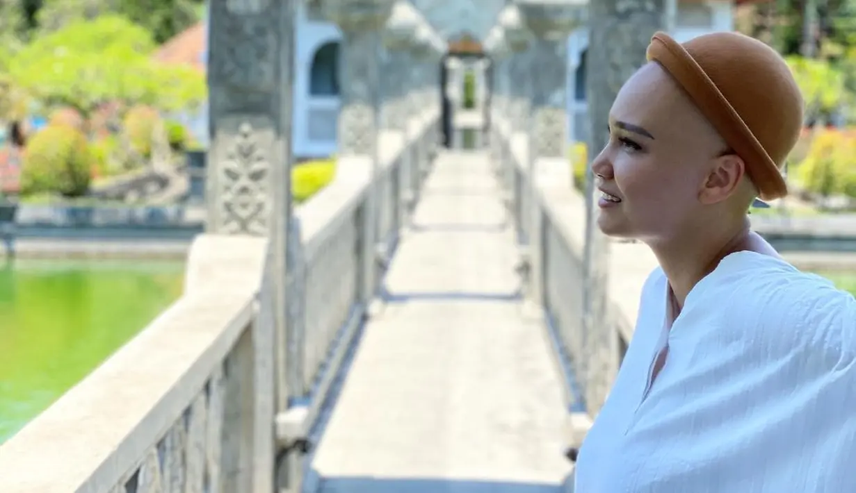 "Malah lebih happy setelah kena kanker. Karena dulu selalu berpikir gimana kalau sesuatu yang buruk terjadi padaku, dan sekarang hal buruk itu sudah terjadi padaku," ujar Feby Febiola. (Instagram/febyfebiola_)