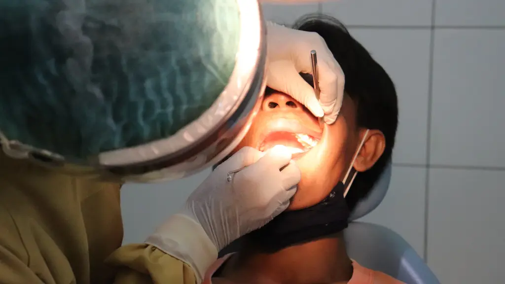 Ilustrasi Gigi Berlubang/https://unsplash.com/Mufid Majnun