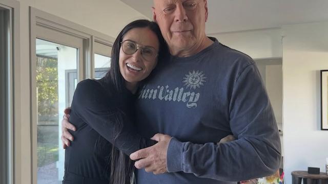 Bruce Willis's Current Status: His Journey Against Frontotemporal Dementia