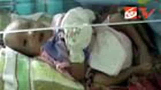 Bayi tanpa Dinding Perut dan Anus
