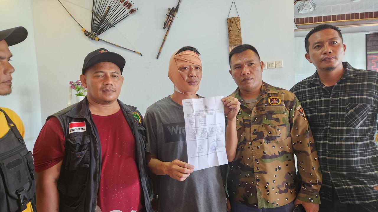 Korban memperlihatkan laporan polisi usai mengalami penganiayaan diduga dilakukan oknum ormas di wilayah Depok. (Liputan6.com/Dicky Agung Prihanto)