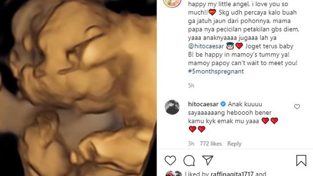 Felicya Angelista - Immanuel Caesar Hito (Foto: Instagram/@felicyangelista_)