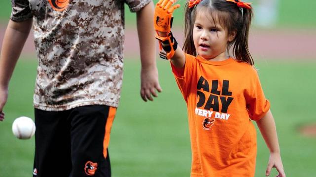 Gadis Kecil Berlengan Robot Jadi Idola di Lomba Baseball Dunia