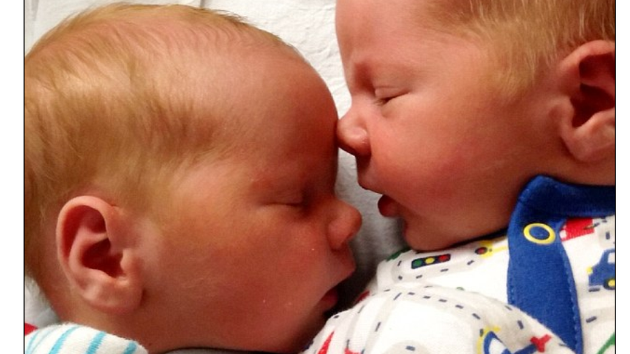 Bayi kembar di Skotlandia 